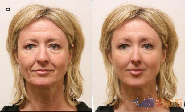 big 1239716947 27820 F8I81UH